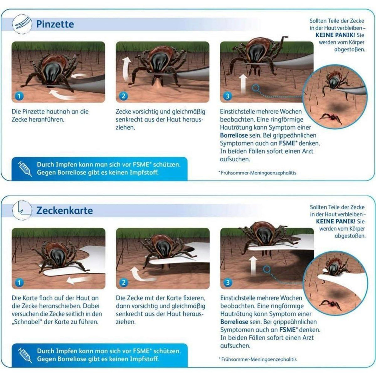 Zeckenzange Edelstahl Profi Set für Hund, Katze, Mensch