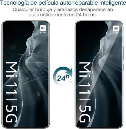 Displayschutz Xiaomi Mi 11 Pro 3 Stück TPU HD klar weich transparent