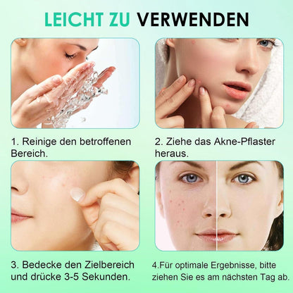Hydrokolloid Pickel Patches – 264 Stück – Unsichtbar & Wasserfest