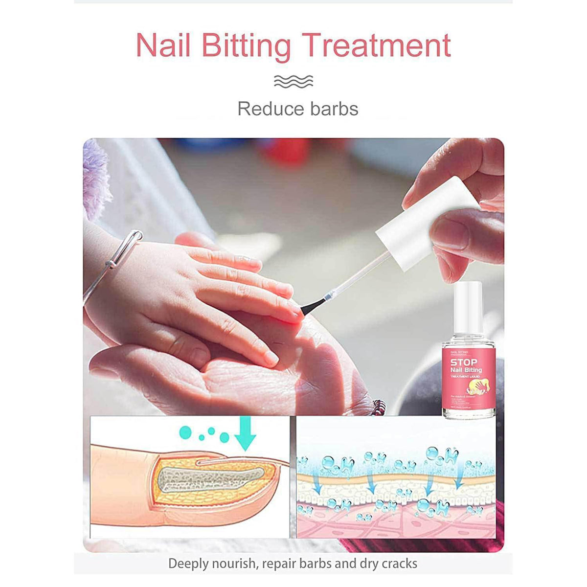 Nagellack gegen Nägelkauen – Anti-Nagelkaul-Lack für Kinder & Erwachsene