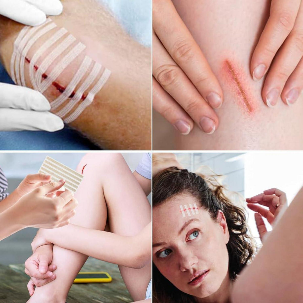 Wundverschlussstreifen Set – 48 Stück für schnelle Wundversorgung